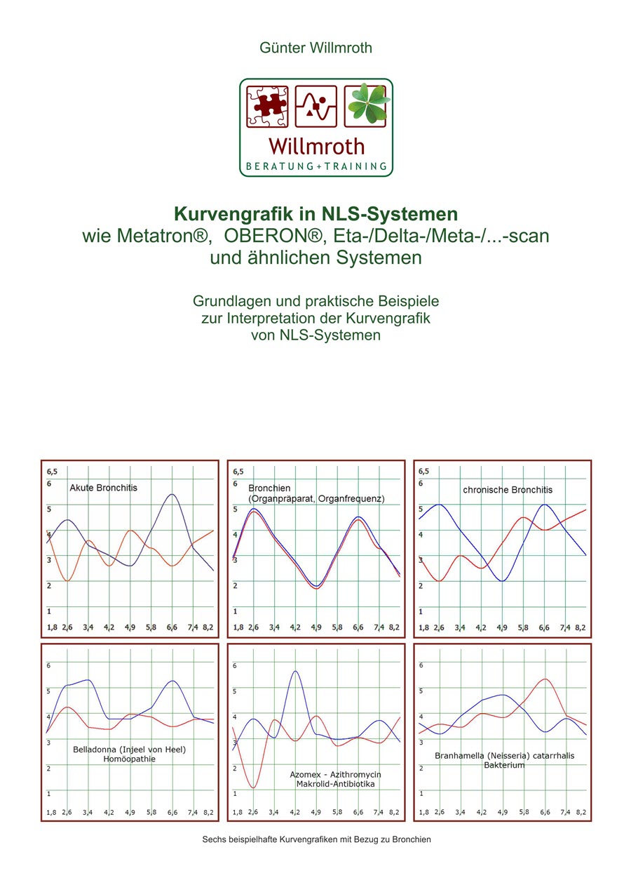Kurvengrafik Vorderseite